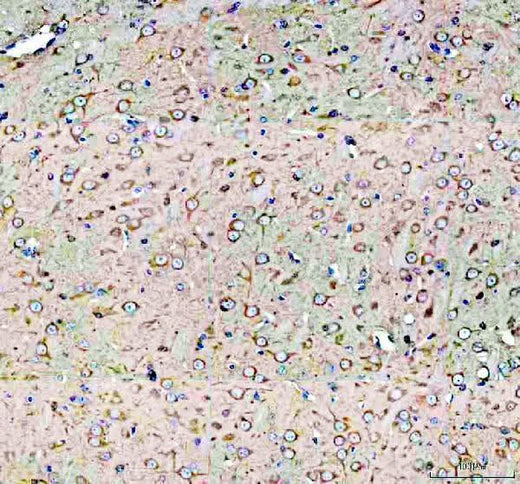 Anti-DYNC1H1 Antibody Boster Bio