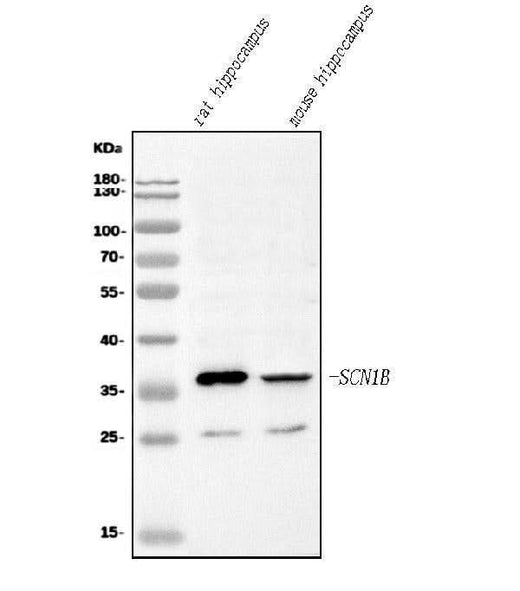 Anti-SCN1B Antibody Picoband® Boster Bio