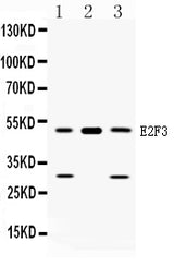 Anti-E2F3 Antibody Picoband® Boster Bio
