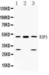 Anti-E2F3 Antibody Picoband® Boster Bio