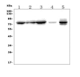 Anti-MTA2/PID Picoband® Antibody Boster Bio