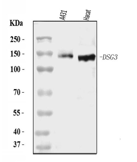 Anti-Desmoglein 3/PVA/DSG3 Antibody Picoband® Boster Bio
