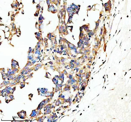 Anti-SPON1 Antibody Boster Bio