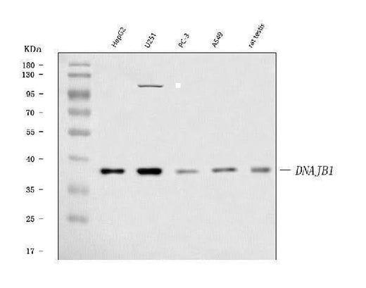 Anti-Hsp40/DNAJB1 Antibody Picoband® Boster Bio