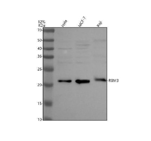 Anti-RBM3 Antibody Picoband® Boster Bio