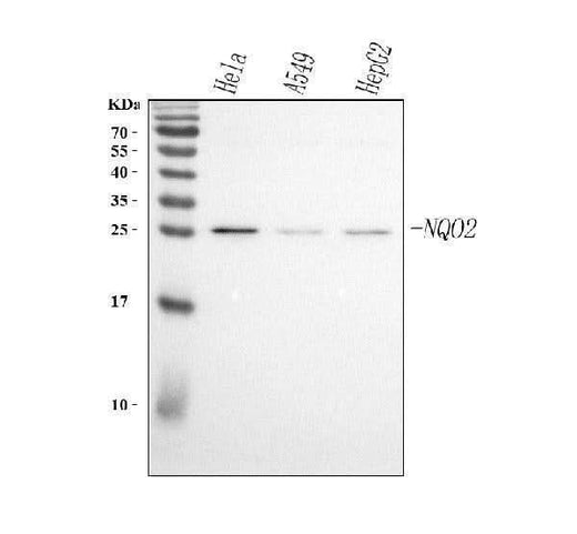 Anti-NQO2 Antibody Picoband® Boster Bio