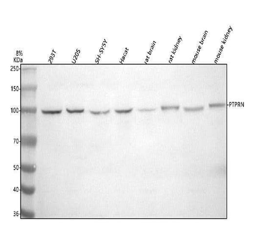 Anti-IA-2/PTPRN Antibody Picoband® Boster Bio