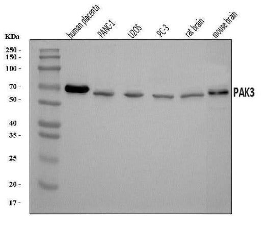 Anti-PAK3 Antibody Picoband® Boster Bio