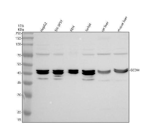Anti-GCDH Antibody Picoband® Boster Bio