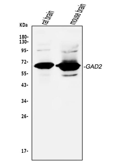Anti-GAD65/GAD2 Antibody Picoband® Boster Bio