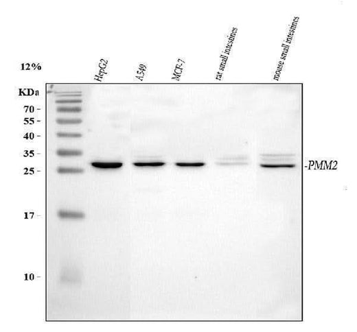 Anti-PMM2 Antibody Picoband® Boster Bio