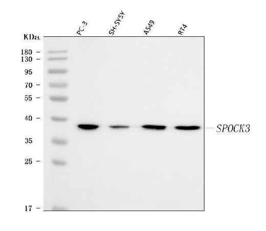Anti-SPOCK3 Antibody Picoband® Boster Bio