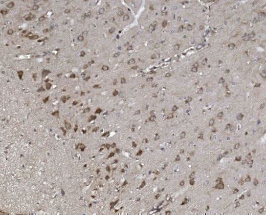 Anti-Synaptopodin/SYNPO Antibody Picoband® Boster Bio
