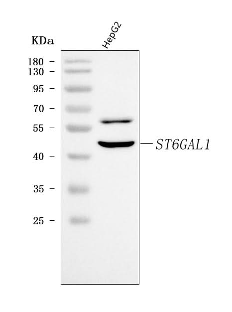 Anti-CDw75/ST6GAL1 Antibody Picoband® Boster Bio