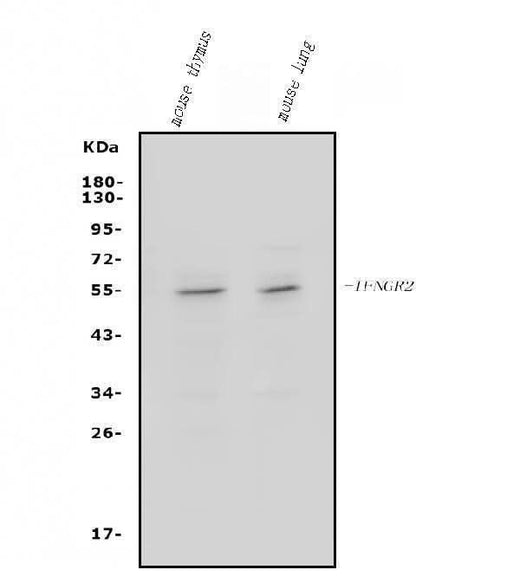 Anti-IFN gamma Receptor beta/AF-1/IFNGR2 Antibody Picoband® Boster Bio