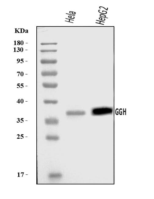 Anti-GGH Antibody Picoband® Boster Bio