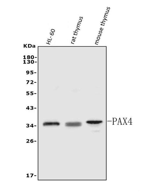 Anti-PAX4 Antibody Picoband® Boster Bio