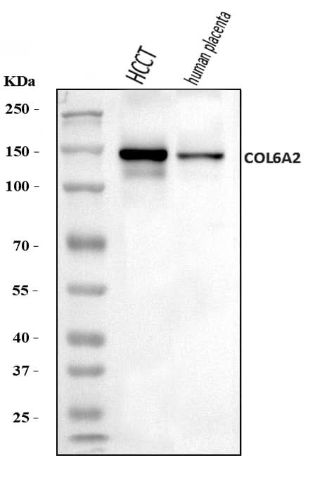 Anti-Collagen VI/COL6A2 Antibody Picoband® Boster Bio