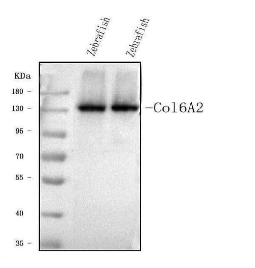 Anti-col6a2 Antibody Picoband® Boster Bio