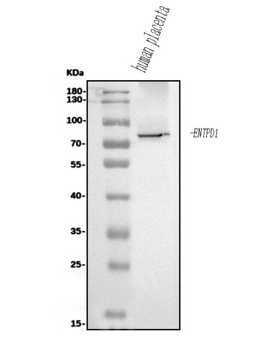 Anti-CD39/ENTPD1 Antibody Picoband® Boster Bio