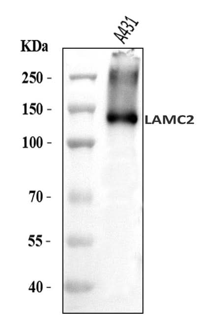 Anti-LAMC2 Antibody Picoband® Boster Bio
