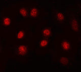 Anti-MAX Antibody Picoband® Boster Bio