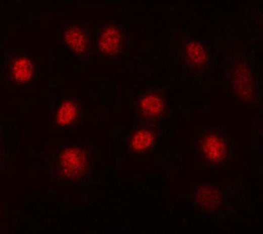 Anti-MAX Antibody Picoband® Boster Bio