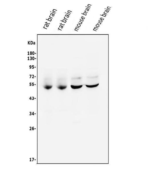 Anti-CaMKII alpha/CAMK2A Antibody Picoband® Boster Bio
