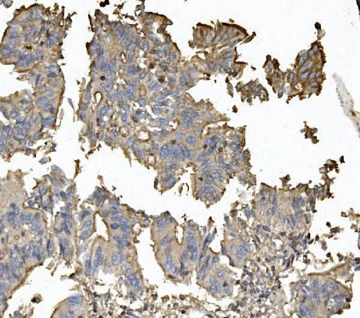 Anti-Claudin 5/CLDN5 Antibody Boster Bio