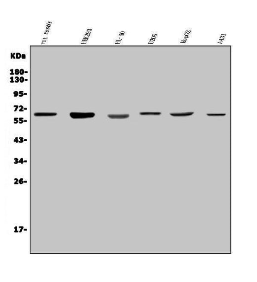 Anti-PARP2 Antibody Picoband® Boster Bio