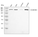 Anti-CCDC88A Antibody Picoband® Boster Bio