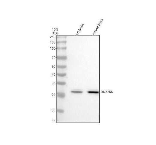 Anti-DNAJB6 Antibody Picoband® Boster Bio
