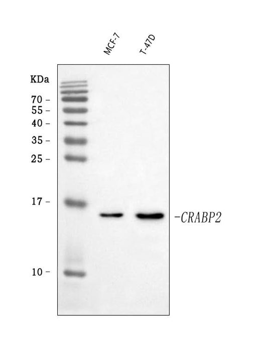 Anti-CRABP2 Antibody Picoband® Boster Bio