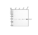 Anti-CDKN2C Antibody Picoband® Boster Bio