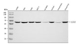 Anti-Asparagine synthetase/ASNS Antibody Picoband® Boster Bio