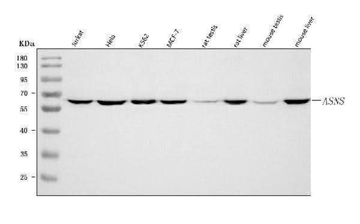 Anti-Asparagine synthetase/ASNS Antibody Picoband® Boster Bio