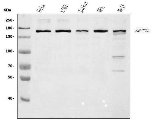 Anti-SMARCC1/BAF155 Antibody Picoband® Boster Bio