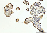 Anti-FGF3 Antibody Boster Bio