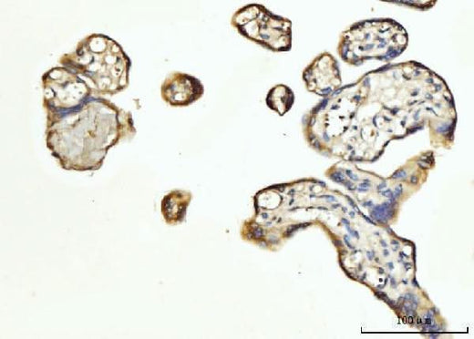 Anti-FGF3 Antibody Boster Bio
