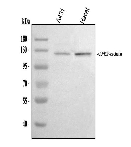 Anti-P-Cadherin-3 CDH3-Antibody Picoband® Boster Bio