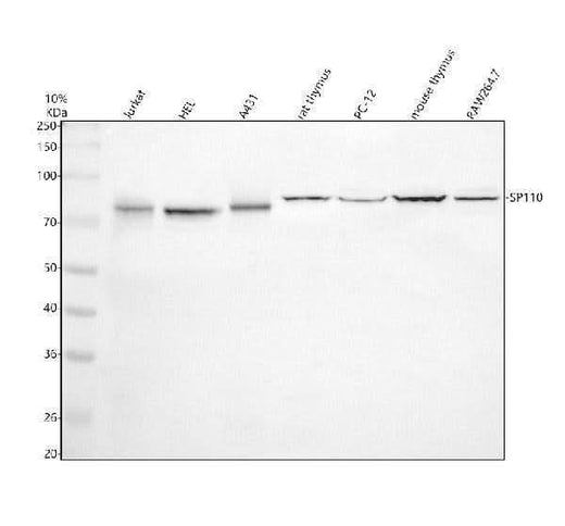Anti-SP110 Antibody Picoband® Boster Bio