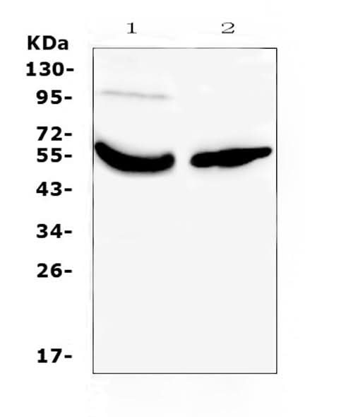 Anti-Vitamin D Binding protein/GC Antibody Picoband® Boster Bio