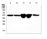 Anti-Vitamin D Binding protein/Gc Antibody Picoband® Boster Bio