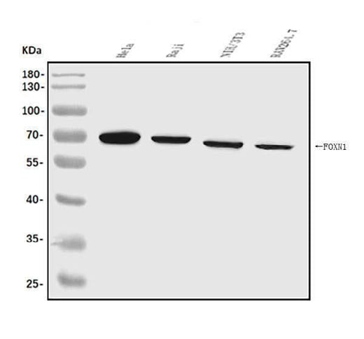 Anti-FOXN1 Antibody Picoband® Boster Bio