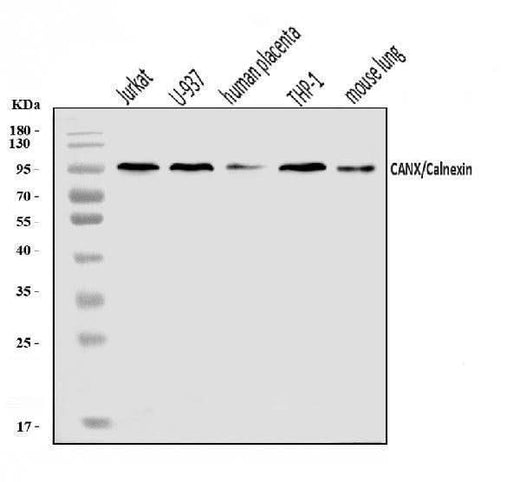 Anti-Calnexin/CANX Antibody Picoband® Boster Bio