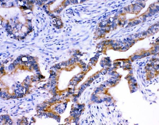 Anti-Stanniocalcin 1/STC/STC1 Antibody Boster Bio