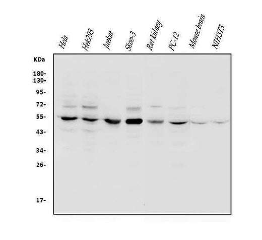 Anti-VPS4B/MIG1 Antibody Picoband® Boster Bio