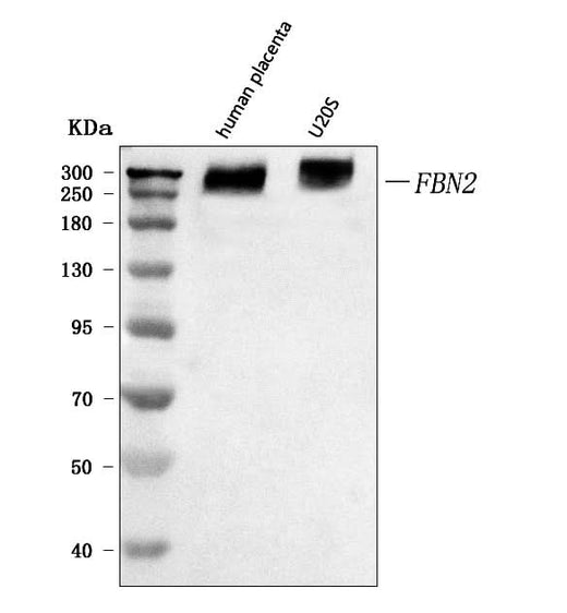 Anti-fibrillin 2/FBN2 Antibody Picoband® Boster Bio