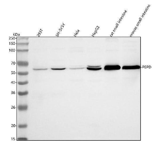 Anti-PEPD Antibody Picoband® Boster Bio