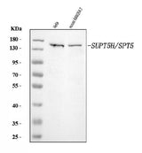 Anti-SPT5/SUPT5H Antibody Picoband® Boster Bio